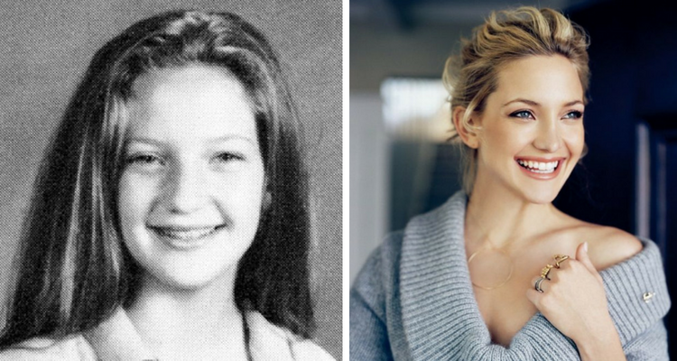 kate hudson antes y despues