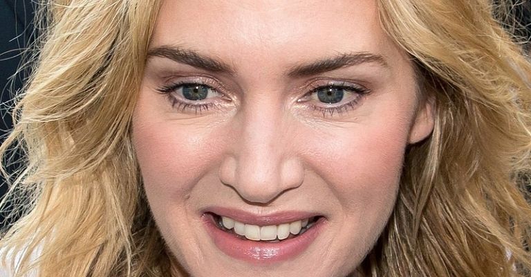 kate-winslet-cirugias